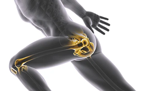 Orthopedic & Joint Replacement